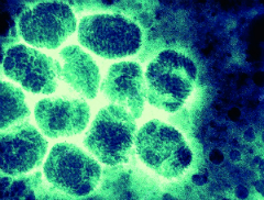 A varloa  causada pelo vrus Orthopoxvirus variolae.